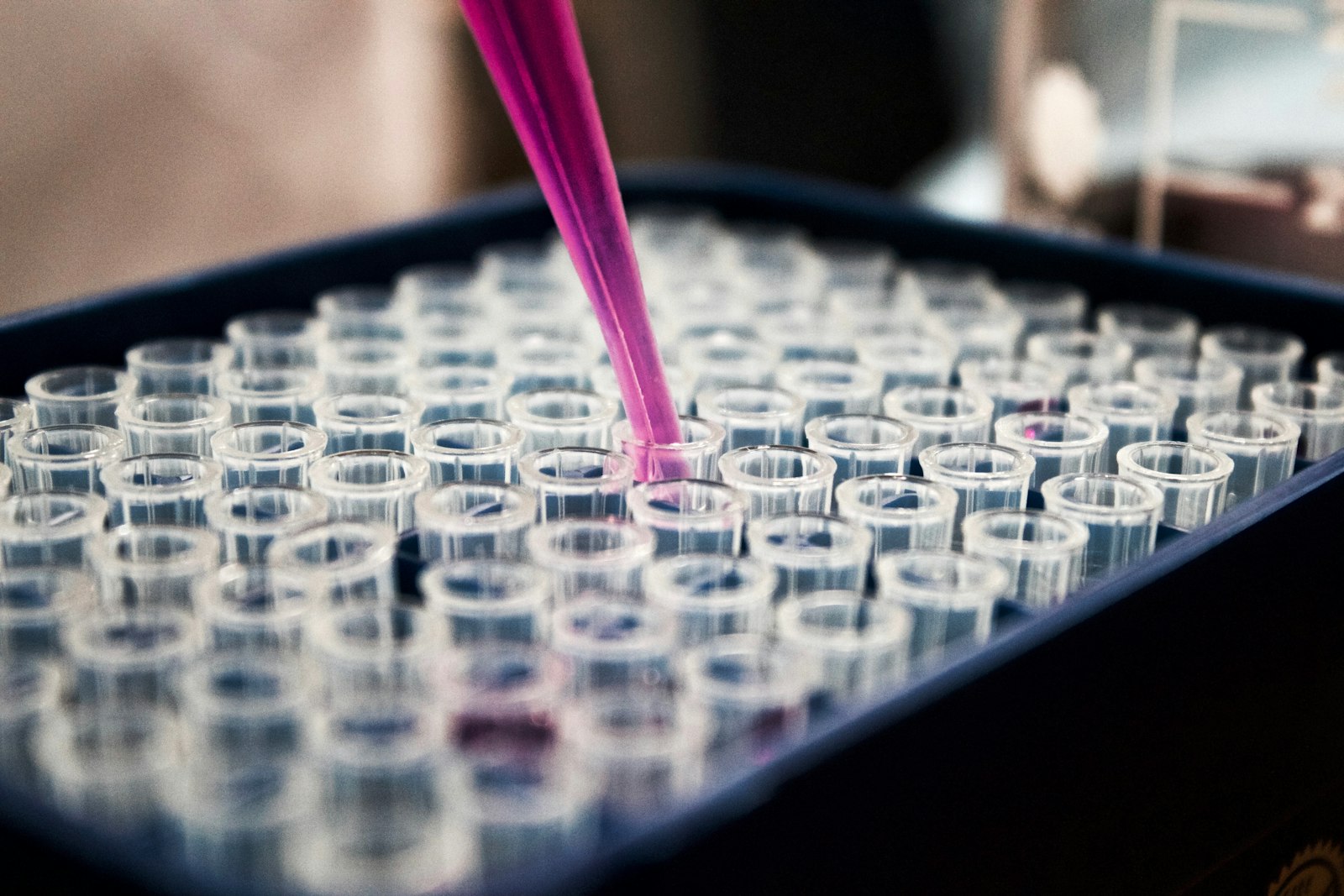 Equipo de laboratorio utilizado como referencia visual para una prueba genética de ADN